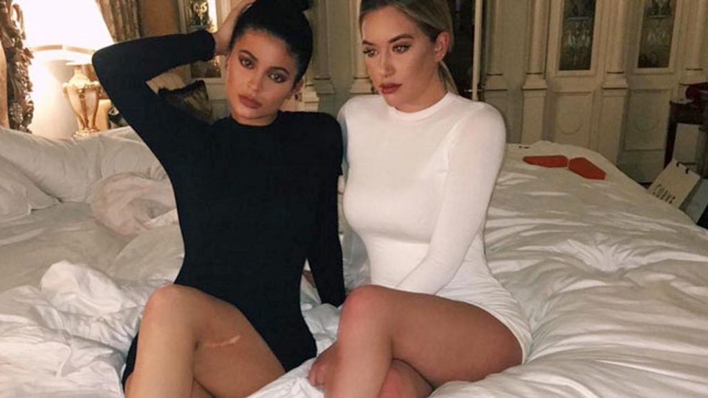 Kylie Jenner (izquierda) mostrando una cicatriz hipertrófica en su pierna.