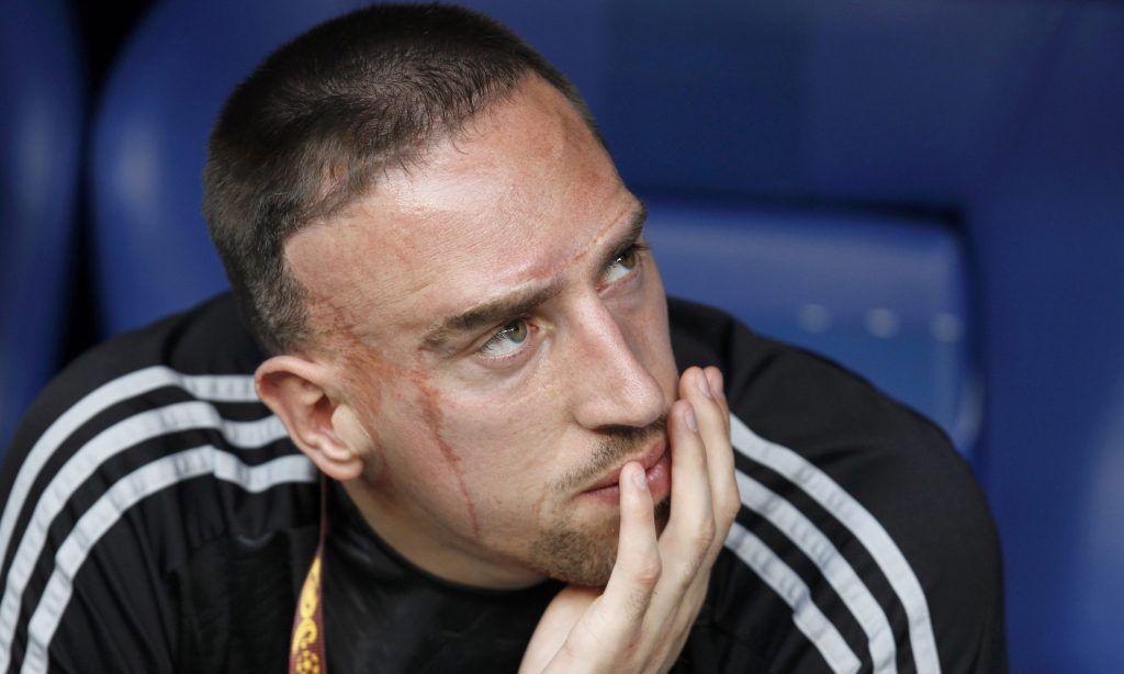 El famoso futbolista francés Franck Ribéry sufrió un accidente de coche en su infancia que le dejó visibles cicatrices.