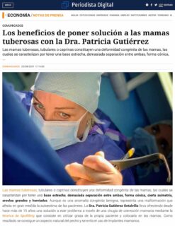 Los beneficios de poner solución a las mamas tuberosas con la Dra. Patricia Gutiérrez (Periodista Digital).